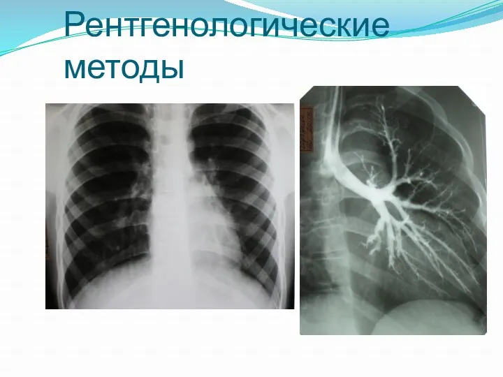 Рентгенологические методы