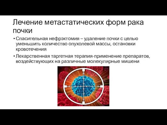 Лечение метастатических форм рака почки Спасительная нефрэктомия – удаление почки