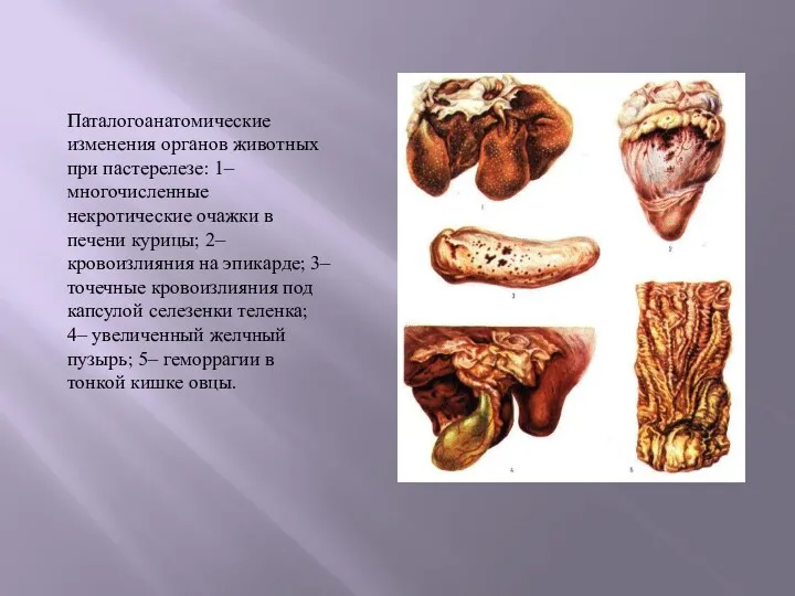 Паталогоанатомические изменения органов животных при пастерелезе: 1– многочисленные некротические очажки в печени курицы;