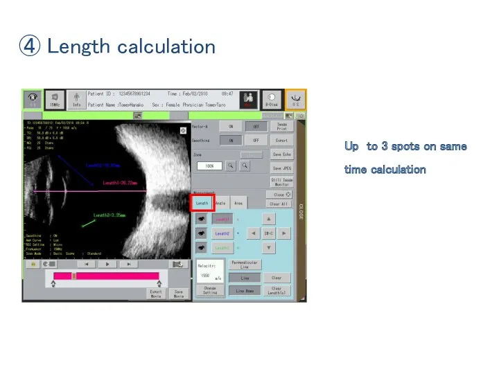 ④ Length calculation Up to 3 spots on same time calculation