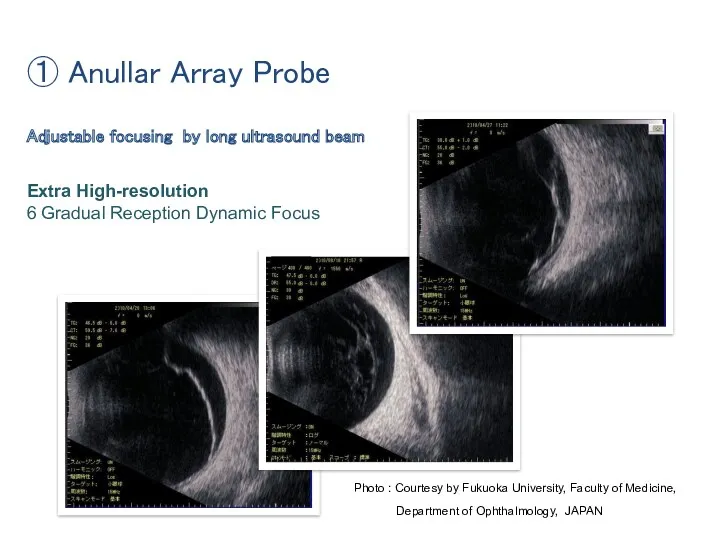 Adjustable focusing by long ultrasound beam Extra High-resolution 6 Gradual