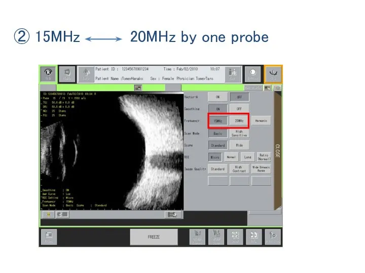 ② 15MHz 20MHz by one probe
