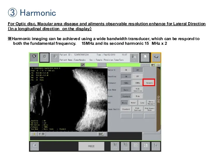 ③ Harmonic For Optic disc, Macular area disease and ailments