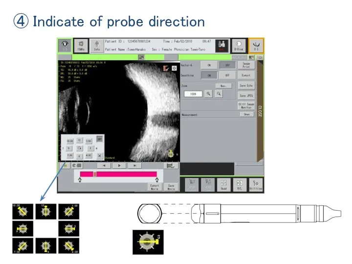 ④ Indicate of probe direction