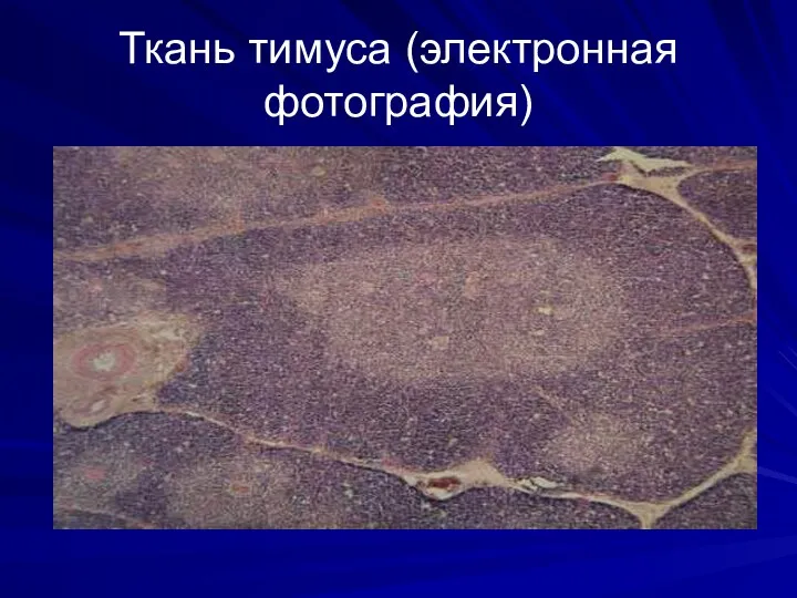 Ткань тимуса (электронная фотография)