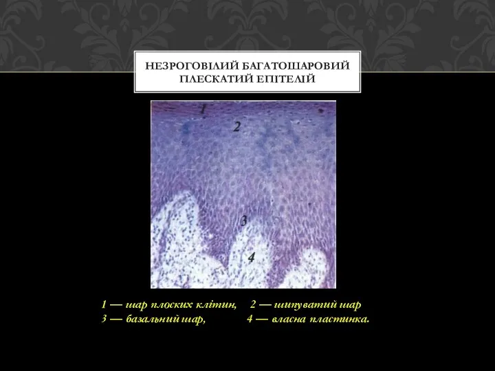 НЕЗРОГОВІЛИЙ БАГАТОШАРОВИЙ ПЛЕСКАТИЙ ЕПІТЕЛІЙ 1 — шар плоских клітин, 2