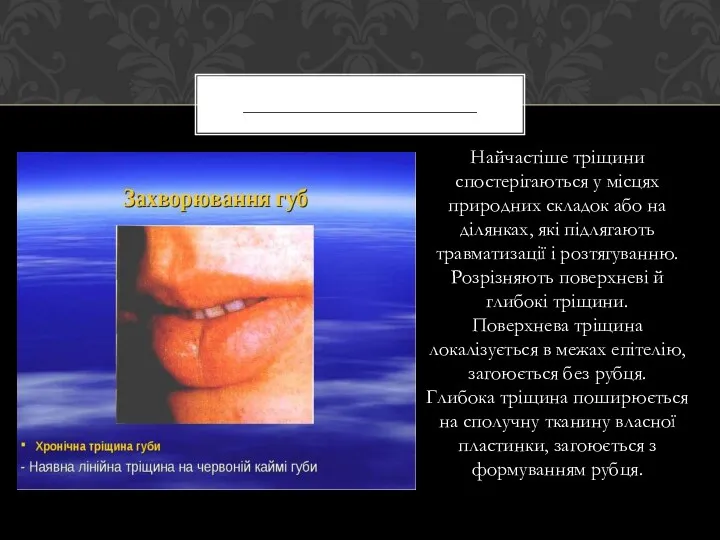 Найчастіше тріщини спостерігаються у місцях природних складок або на ділянках,