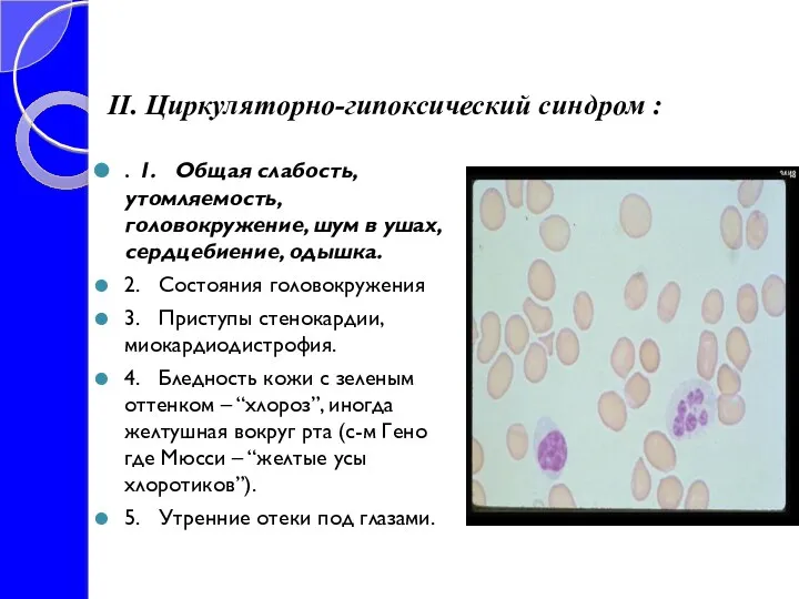 ІІ. Циркуляторно-гипоксический синдром : . 1. Общая слабость, утомляемость, головокружение, шум в ушах,