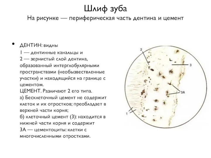 Шлиф зуба На рисунке — периферическая часть дентина и цемент