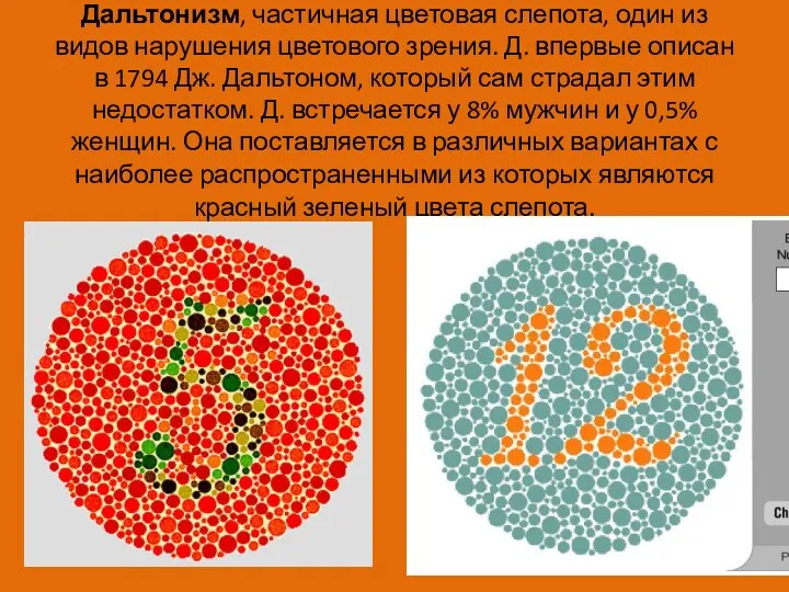 Дальтонизм, частичная цветовая слепота, один из видов нарушения цветового зрения.