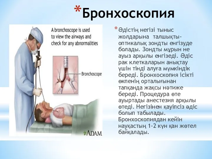 Бронхоскопия Әдістің негізі тыныс жолдарына талшықты- оптикалық зондты енгізуде болады. Зондты мұрын не