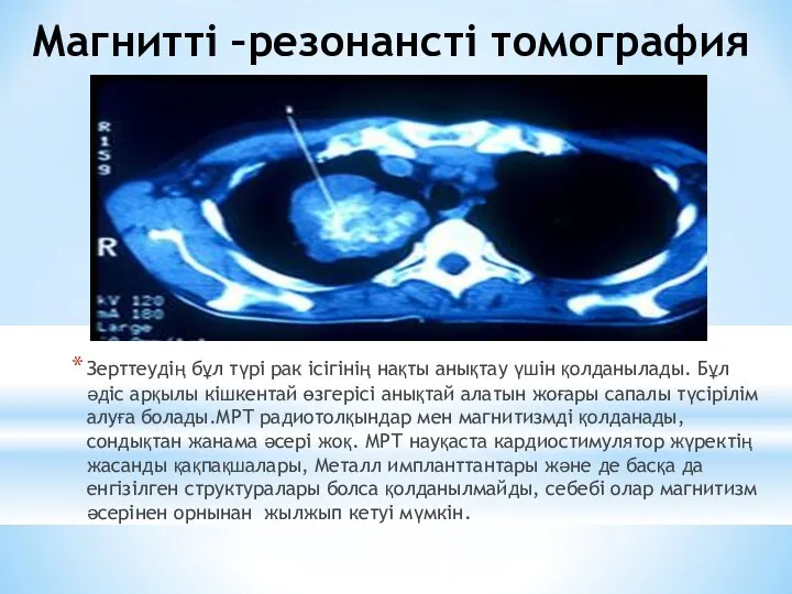 Магнитті –резонансті томография Зерттеудің бұл түрі рак ісігінің нақты анықтау үшін қолданылады. Бұл