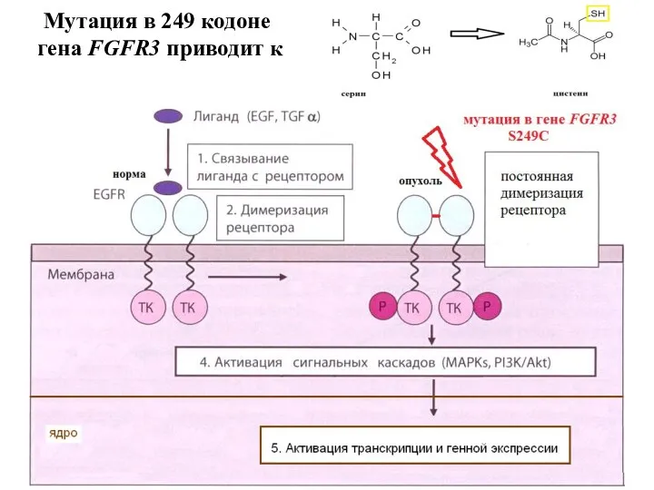 Мутация в 249 кодоне гена FGFR3 приводит к