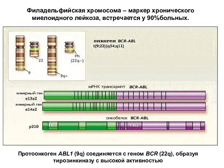 Филадельфийская хромосома – маркер хронического миелоидного лейкоза, встречается у 90%больных.