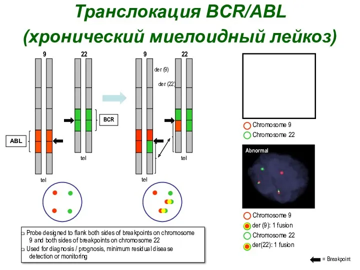 Транслокация BCR/ABL (хронический миелоидный лейкоз) ABL 9 22 BCR tel