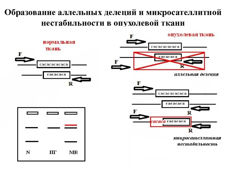 Образование аллельных делеций и микросателлитной нестабильности в опухолевой ткани