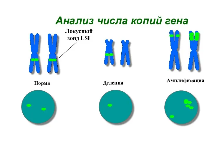 Анализ числа копий гена Норма Делеция Амплификация Локусный зонд LSI