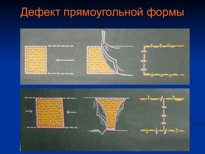 Дефект прямоугольной формы