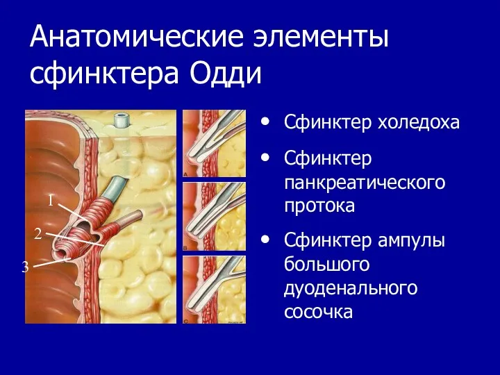 Анатомические элементы сфинктера Одди Сфинктер холедоха Сфинктер панкреатического протока Сфинктер ампулы большого дуоденального