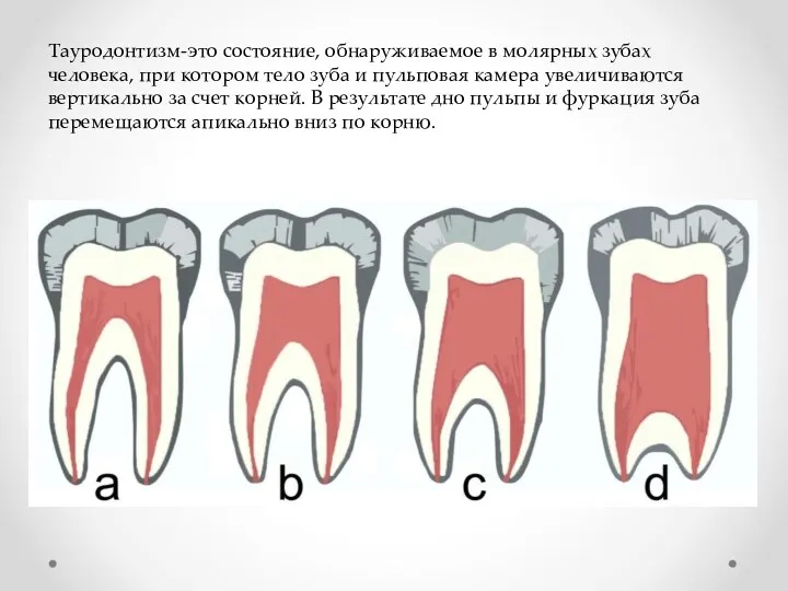 Тауродонтизм-это состояние, обнаруживаемое в молярных зубах человека, при котором тело