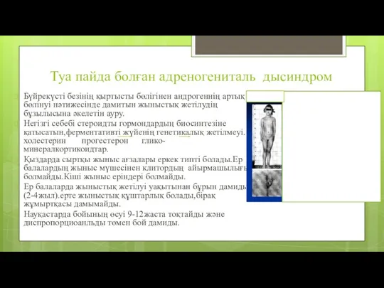 Туа пайда болған адреногениталь дысиндром Бүйрекүсті безінің қыртысты бөлігінен андрогеннің