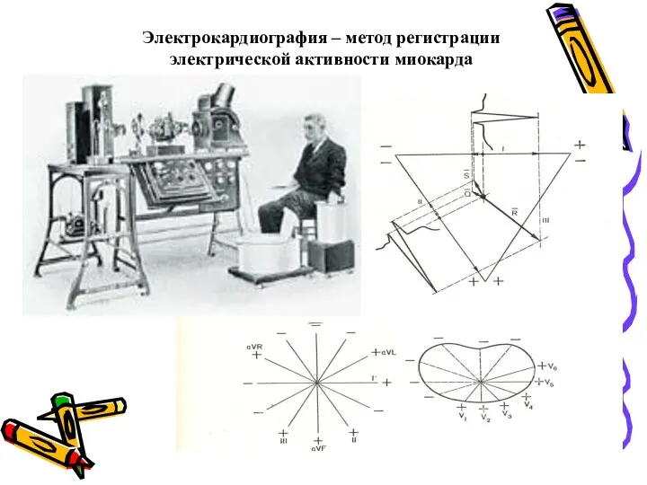 Электрокардиография – метод регистрации электрической активности миокарда