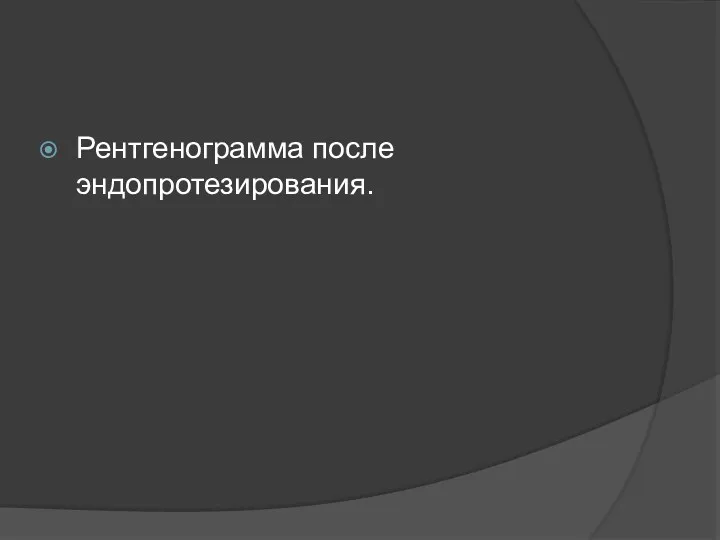 Рентгенограмма после эндопротезирования.