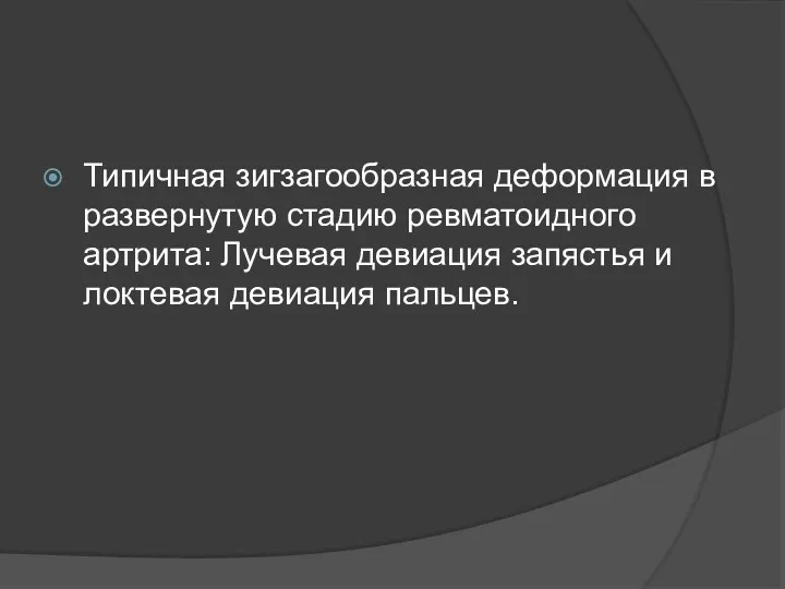 Типичная зигзагообразная деформация в развернутую стадию ревматоидного артрита: Лучевая девиация запястья и локтевая девиация пальцев.