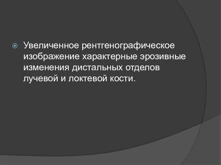 Увеличенное рентгенографическое изображение характерные эрозивные изменения дистальных отделов лучевой и локтевой кости.