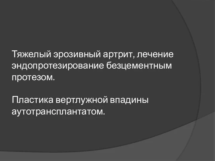 Тяжелый эрозивный артрит, лечение эндопротезирование безцементным протезом. Пластика вертлужной впадины аутотрансплантатом.