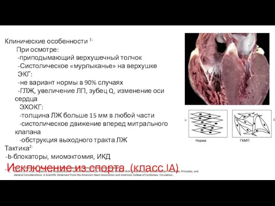 Клинические особенности 1: При осмотре: -приподымающий верхушечный толчок -Систолическое «мурлыканье»