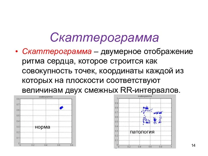 Скаттерограмма Скаттерограмма – двумерное отображение ритма сердца, которое строится как