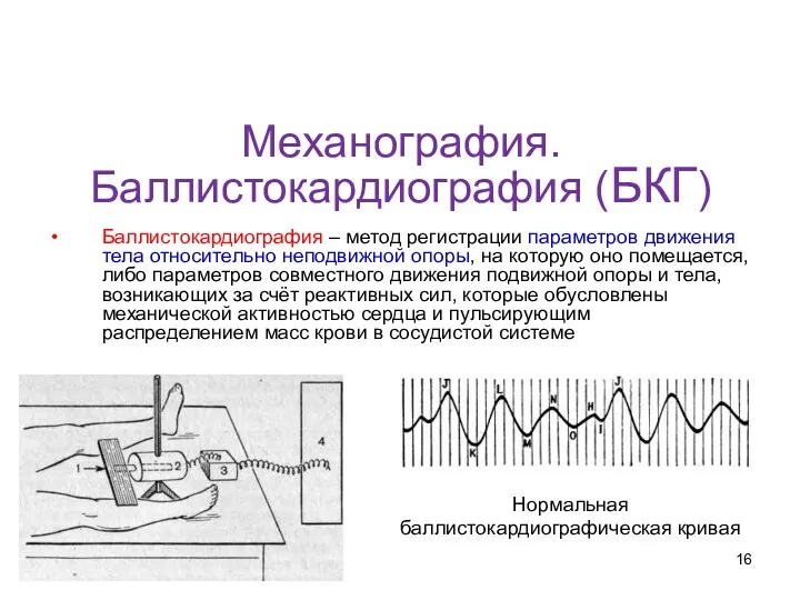 Механография. Баллистокардиография (БКГ) Баллистокардиография – метод регистрации параметров движения тела