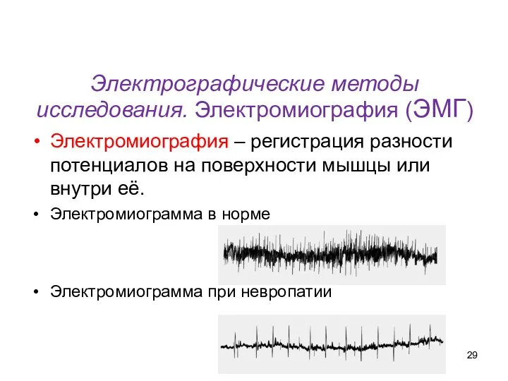 Электрографические методы исследования. Электромиография (ЭМГ) Электромиография – регистрация разности потенциалов