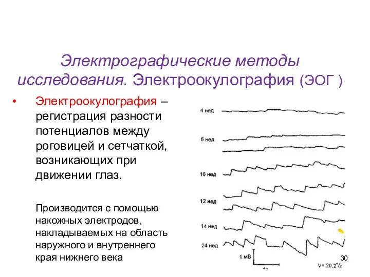 Электрографические методы исследования. Электроокулография (ЭОГ ) Электроокулография – регистрация разности