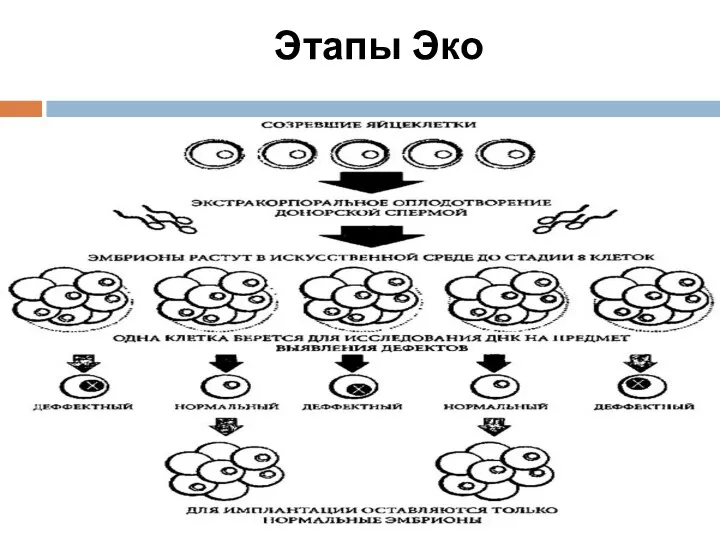 Этапы Эко