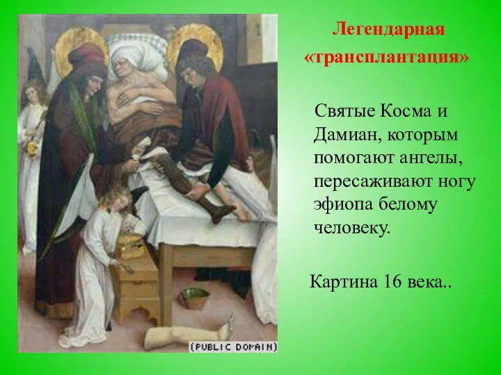 Легендарная «трансплантация» Святые Косма и Дамиан, которым помогают ангелы, пересаживают ногу эфиопа белому