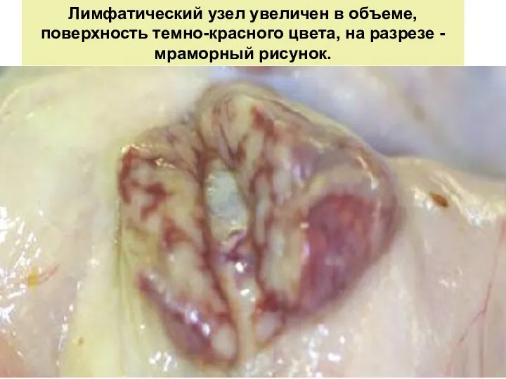 Лимфатический узел увеличен в объеме, поверхность темно-красного цвета, на разрезе - мраморный рисунок.