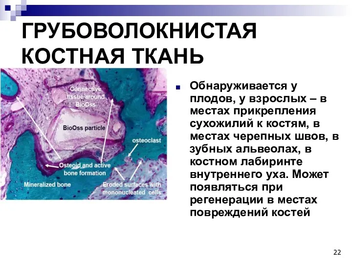 ГРУБОВОЛОКНИСТАЯ КОСТНАЯ ТКАНЬ Обнаруживается у плодов, у взрослых – в местах прикрепления сухожилий