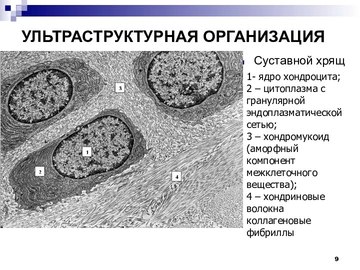 УЛЬТРАСТРУКТУРНАЯ ОРГАНИЗАЦИЯ Суставной хрящ 1- ядро хондроцита; 2 – цитоплазма с гранулярной эндоплазматической