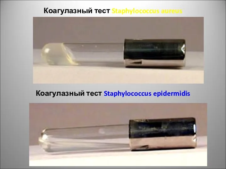 Коагулазный тест Staphylococcus aureus Коагулазный тест Staphylococcus epidermidis