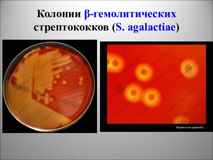 Колонии β-гемолитических стрептококков (S. agalactiae)