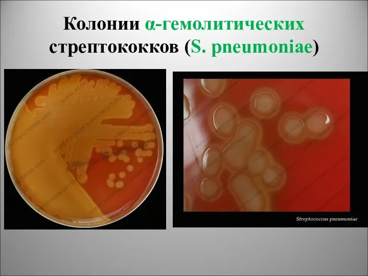 Колонии α-гемолитических стрептококков (S. pneumoniae)