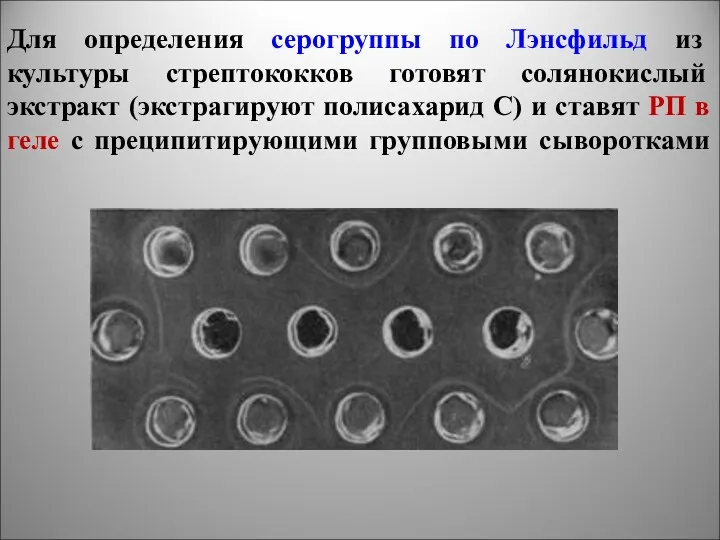 Для определения серогруппы по Лэнсфильд из культуры стрептококков готовят солянокислый