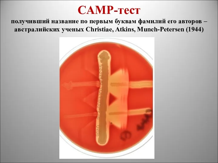 CAMP-тест получивший название по первым буквам фамилий его авторов – австралийских ученых Christiae, Atkins, Munch-Petersen (1944)