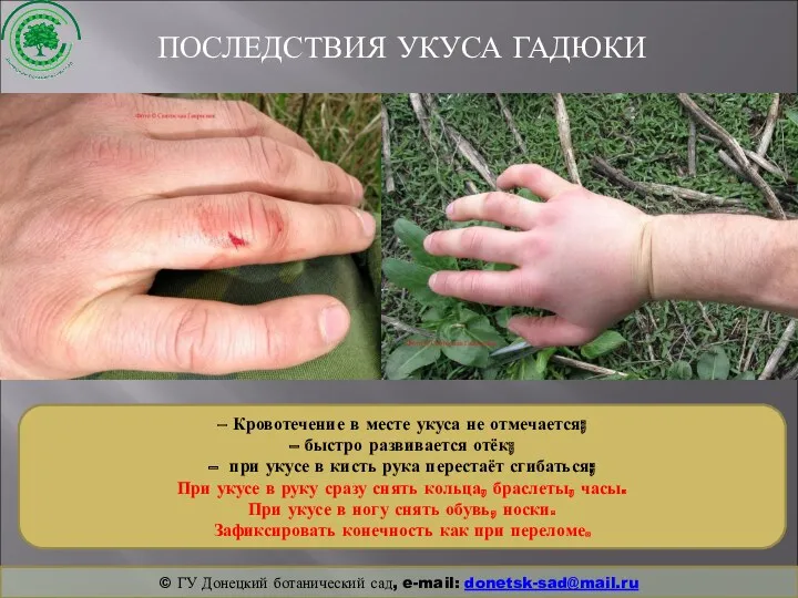 ПОСЛЕДСТВИЯ УКУСА ГАДЮКИ © ГУ Донецкий ботанический сад, e-mail: donetsk-sad@mail.ru – Кровотечение в