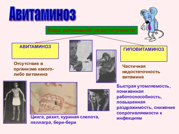 Авитаминоз Виды витаминной недостаточности АВИТАМИНОЗ ГИПОВИТАМИНОЗ Отсутствие в организме какого-либо