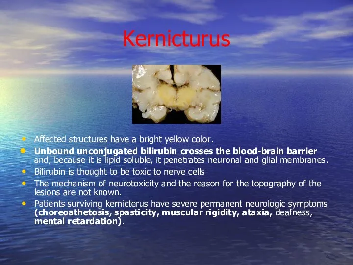 Kernicturus Affected structures have a bright yellow color. Unbound unconjugated