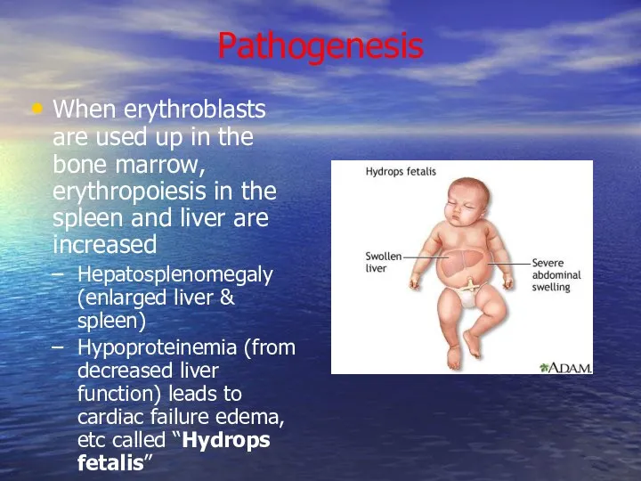 Pathogenesis When erythroblasts are used up in the bone marrow,