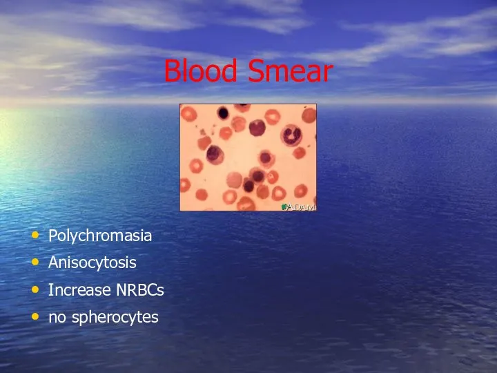Blood Smear Polychromasia Anisocytosis Increase NRBCs no spherocytes